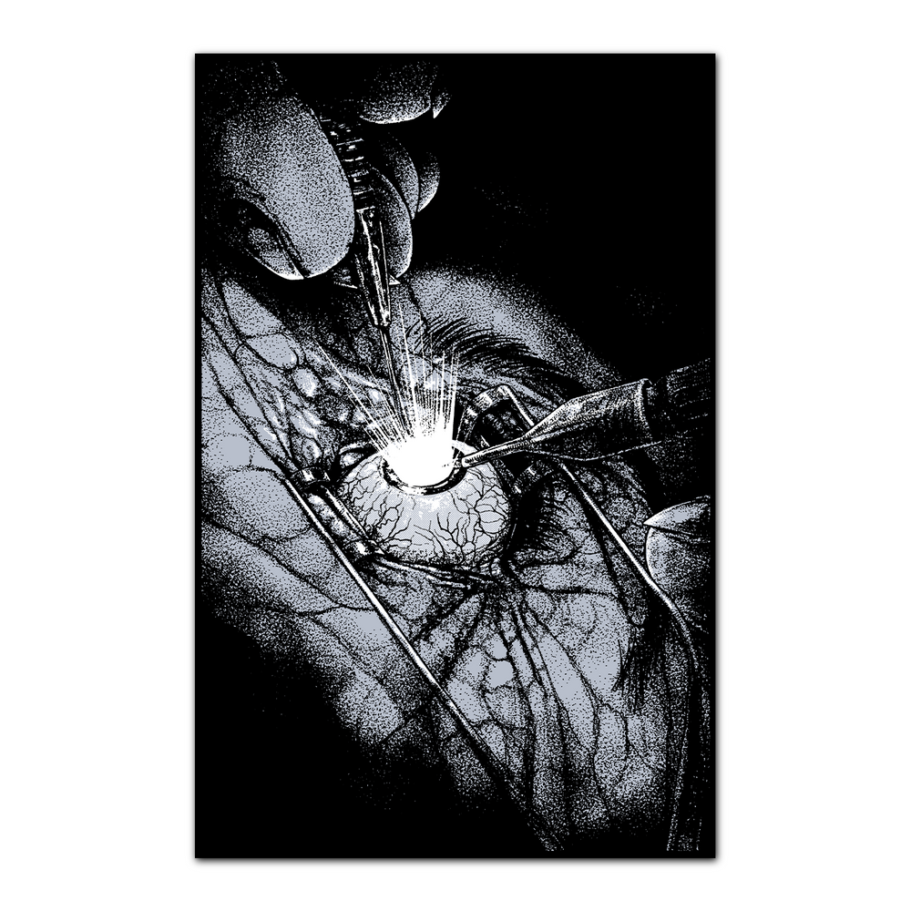 A high-contrast black-and-white illustration by Castle Jackal depicts a close-up of an eye surgery, featuring medical instruments, a slender poster tube, and a bright, focused light.