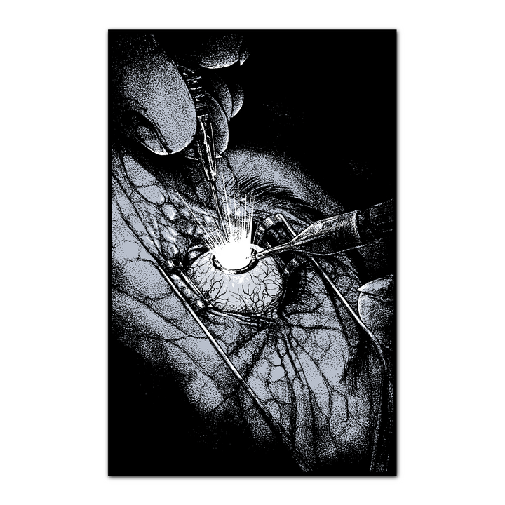 A high-contrast black-and-white illustration by Castle Jackal depicts a close-up of an eye surgery, featuring medical instruments, a slender poster tube, and a bright, focused light.